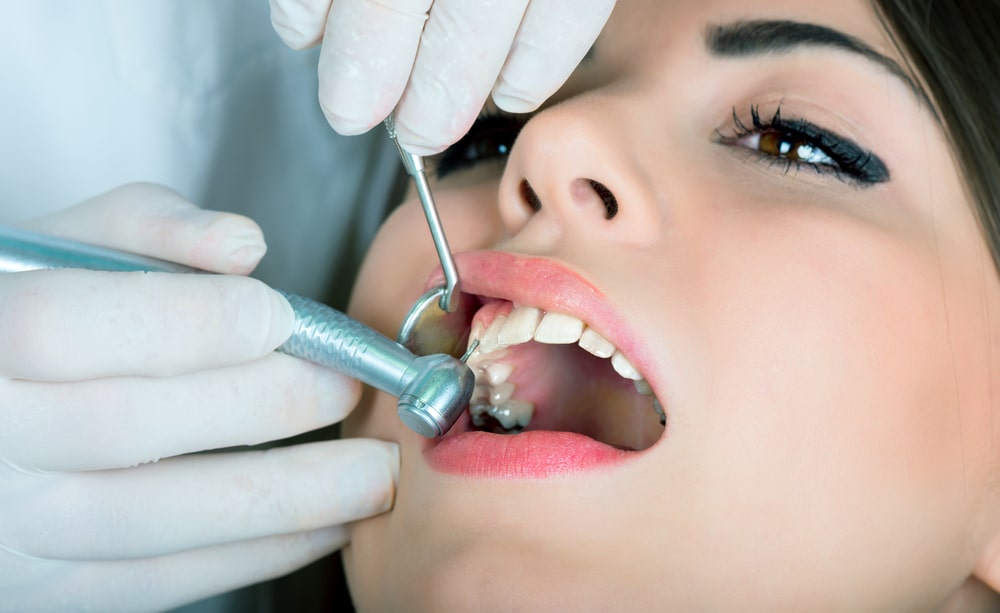 What Are the Long-Term Costs of Maintaining Teeth Implants?